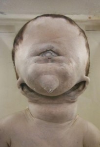 After affects of Atomic bomb at Hiroshima Nagasaki (1)