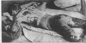 Victim05