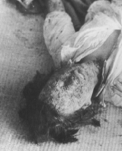 Victim07